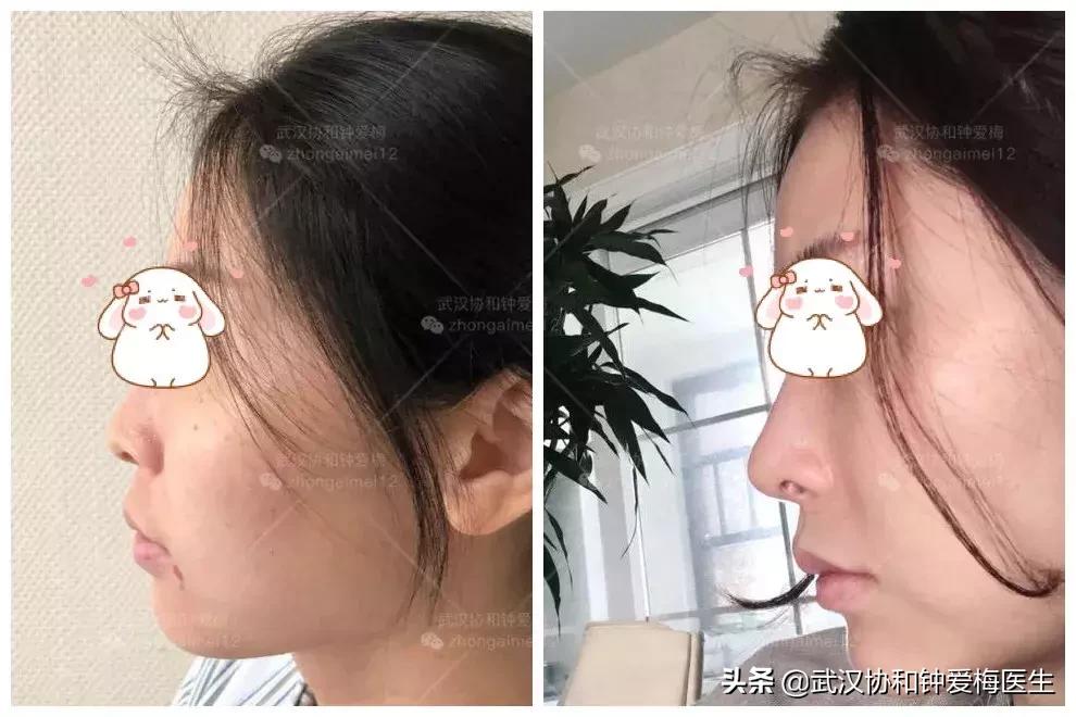 什么样的鼻子好看图片,男生什么样的鼻子最好看