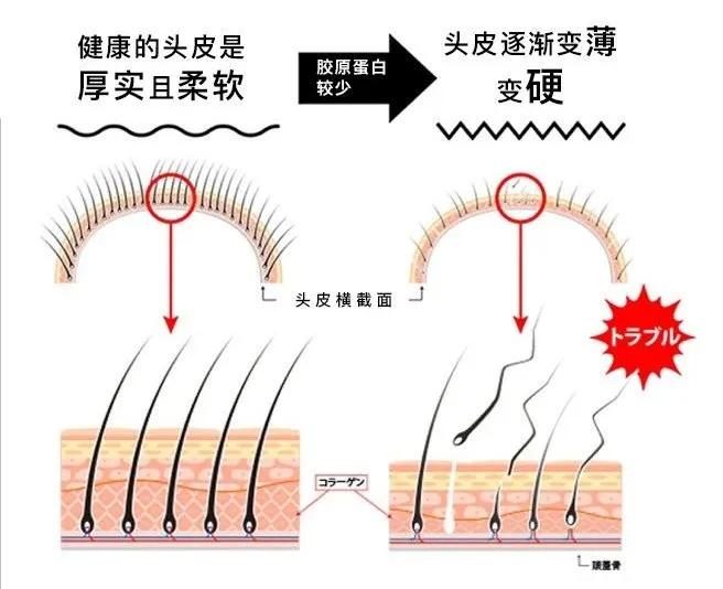 日本蒙琉洗发水,蒙古防掉发洗发水
