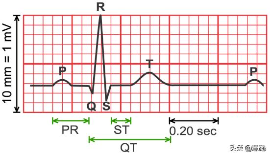 光电心率手表对身体有害吗,心率手表不准是什么问题