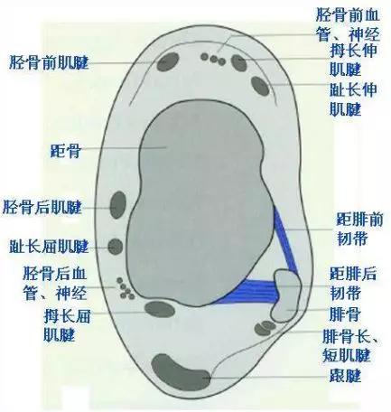 踝关节撞击症问诊,踝关节撞击综合征的x线表现