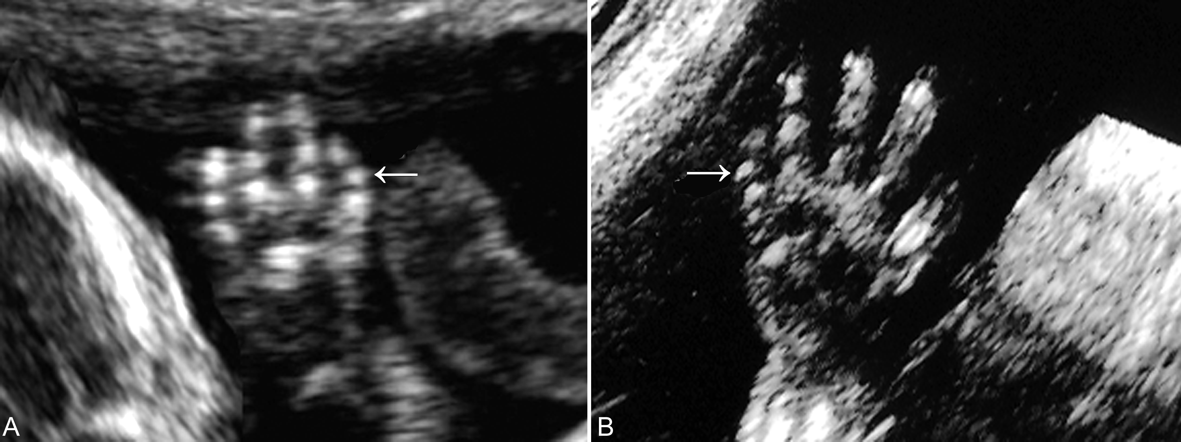 明明白白做b超,明明白白做超声