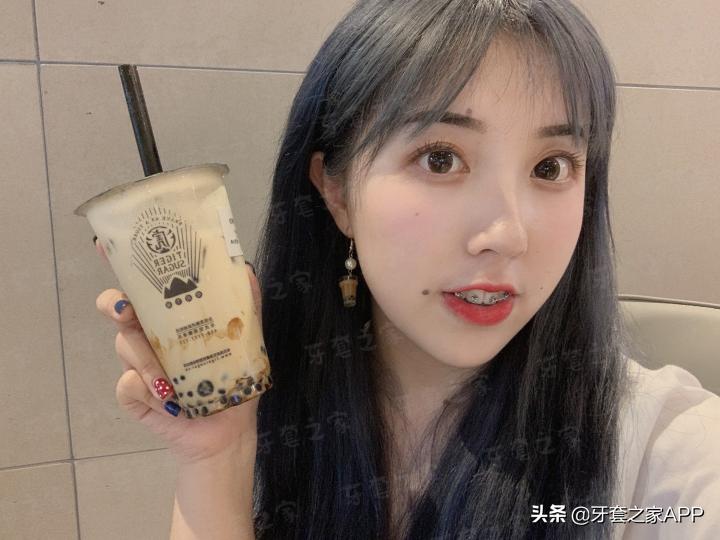 不靠整容怎么改变下巴后缩？看这里