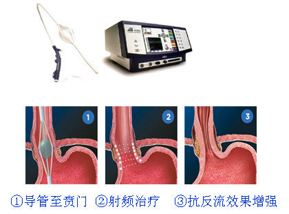 声音嘶哑5年去医院病理说是癌变,喉咙痛声音嘶哑半年喉镜检查正常