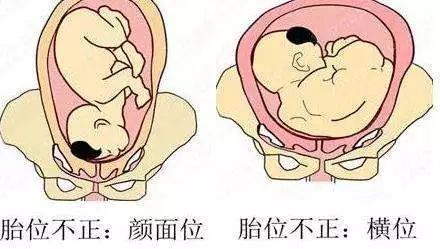 难产一次再次怀孕需要注意什么,难产有哪些内容