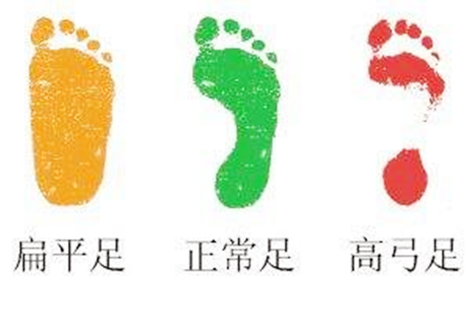 影响孩子脚发育的鞋,什么样的鞋对宝宝足底发育好