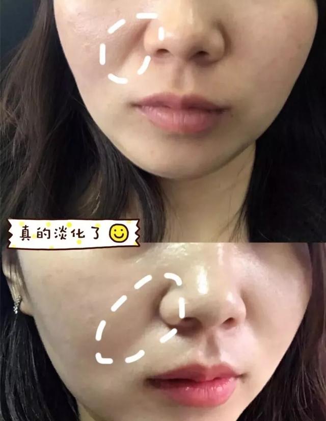 李佳琦推荐十款最好用面霜,李佳琦推荐5款平价面霜