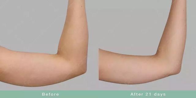 如何瘦双下巴和婴儿肥,小孩怎么快速减掉双下巴