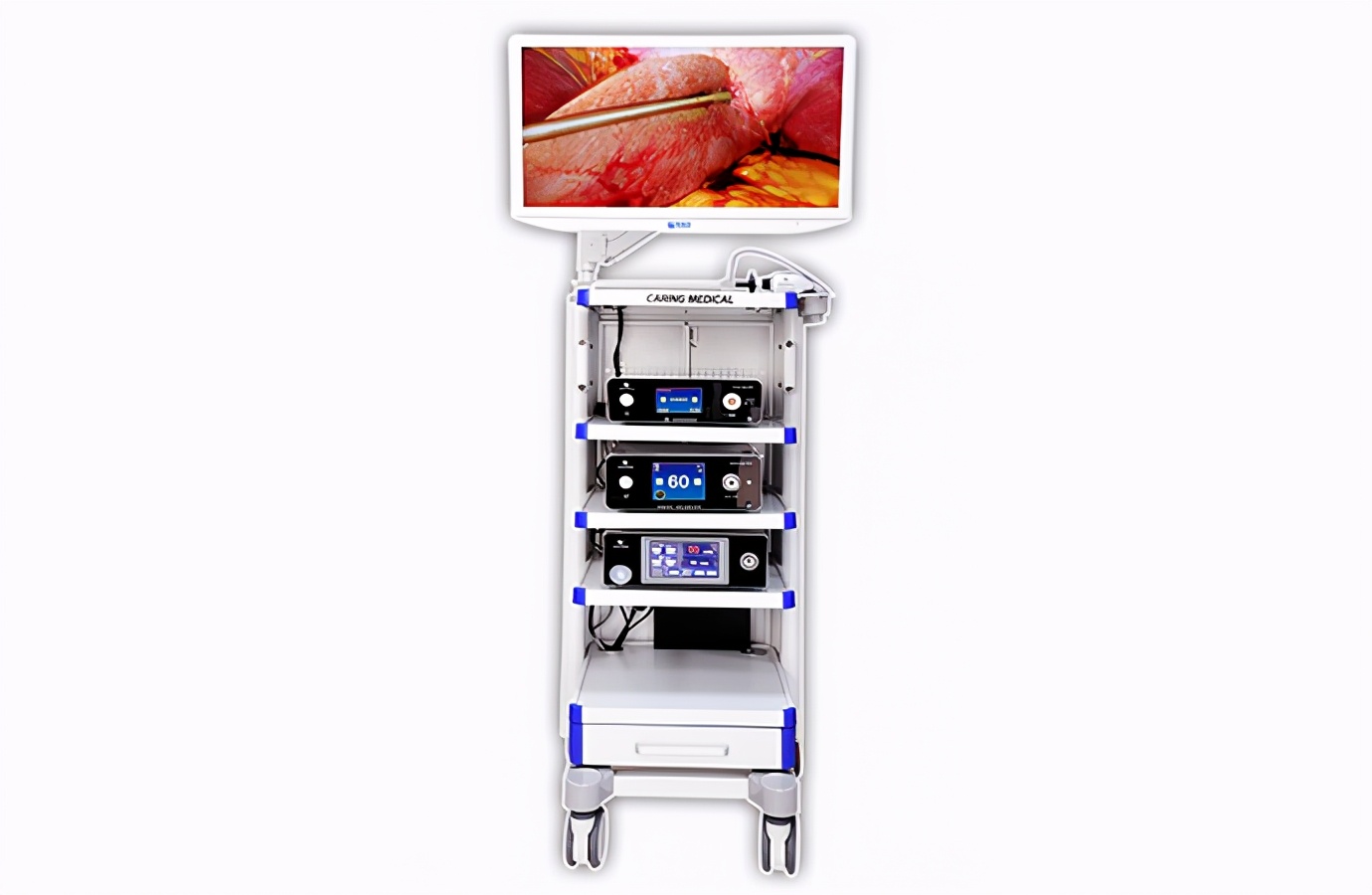 医疗内窥镜装配,医疗内窥镜产品演示