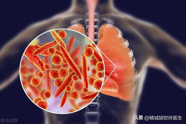 支原体阳性是传染病吗,支原体阳性是引起哮喘吗