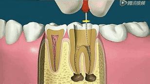 还记得被支配的恐惧吗,澳洲国民牙膏专治黄牙