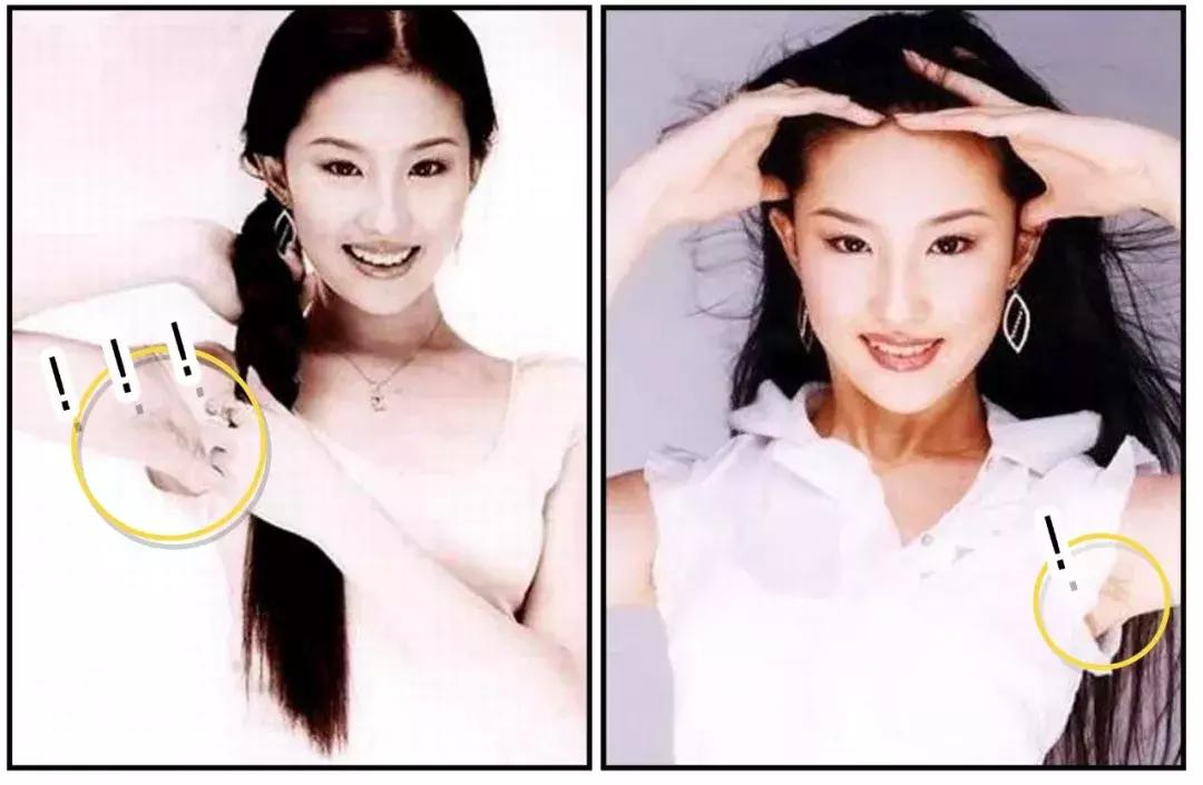 脱毛最好的方法目前最有效的,比较有效的脱毛方法