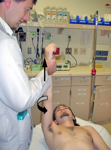 肩脱臼了怎么恢复,肩脱臼怎么彻底恢复