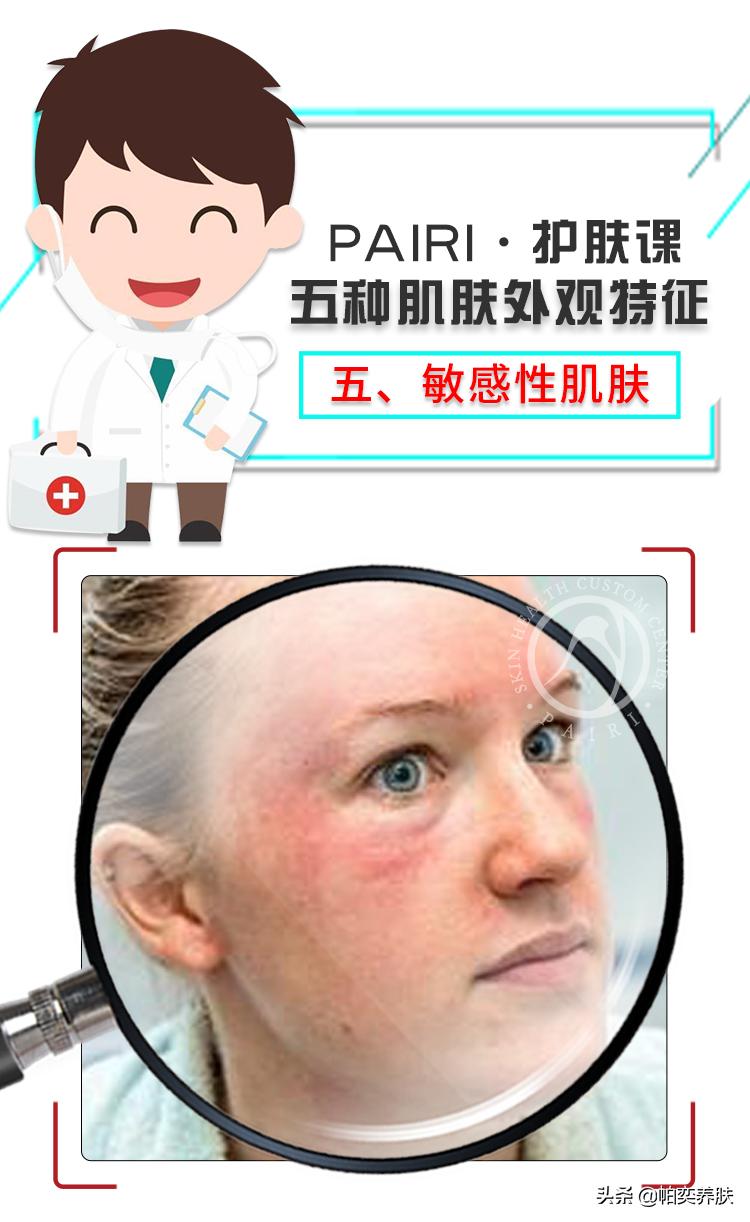 各种肤质特性与护肤要点,帕奕