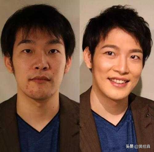 一个长得丑的男生,怎样才能全方位地变帅,改造自己?