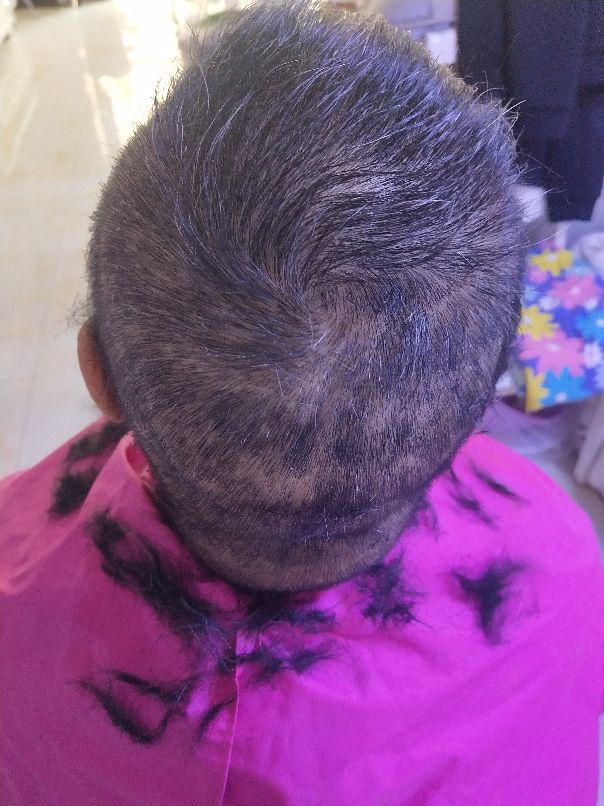 白血病家属如何调整心态,急性白血病人心理疏导的办法