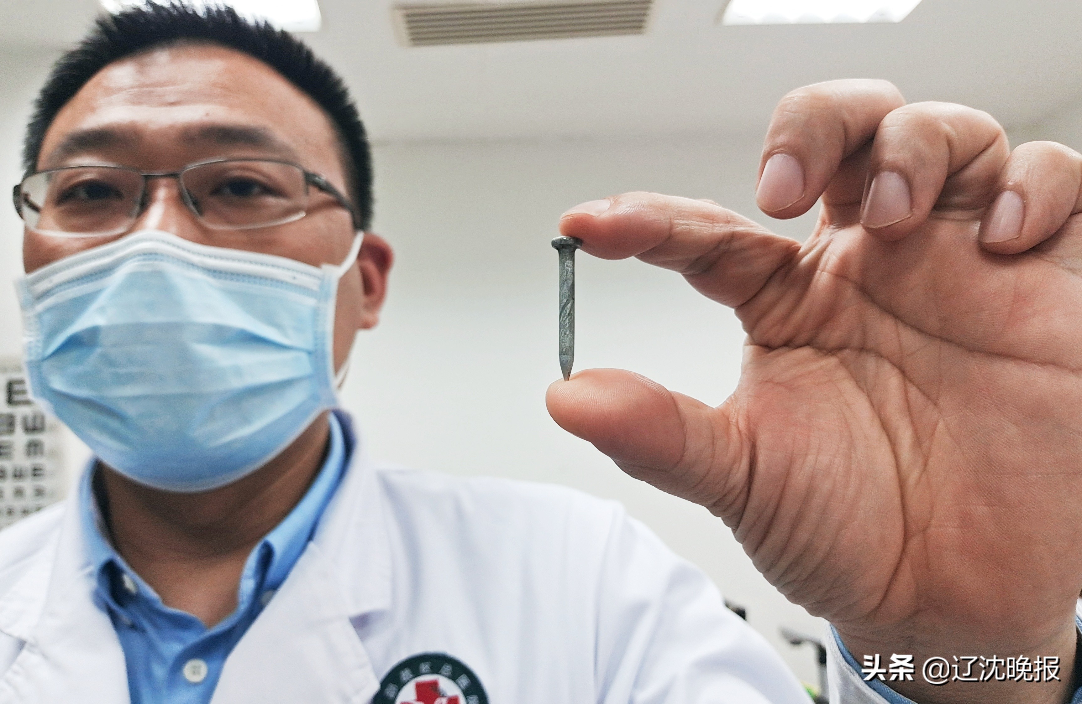 钢钉射进大脑后续,钢钉反弹扎进眼睛9个小时才手术