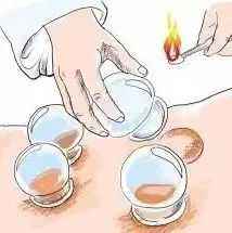 颈部穴位身体穴位图解,什么是穴位