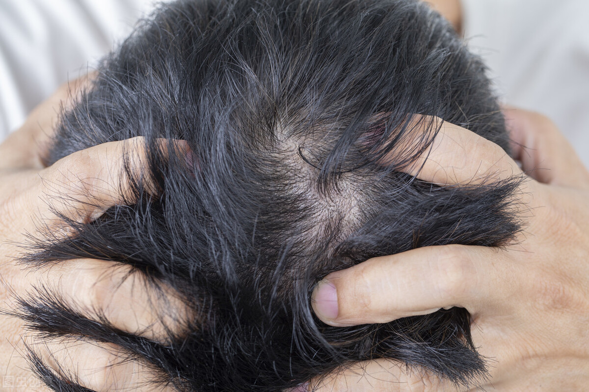 毛囊炎引起的痘痘一般长在哪里,毛囊炎会导致痘痘反复发作吗