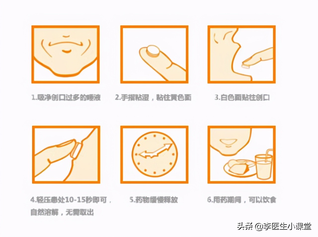 口腔溃疡可以同时吃维b2和维c吗,有一种痛叫口腔溃疡