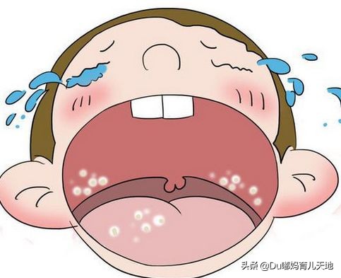 鹅口疮能自愈吗鹅口疮怎么治,什么是鹅口疮啊