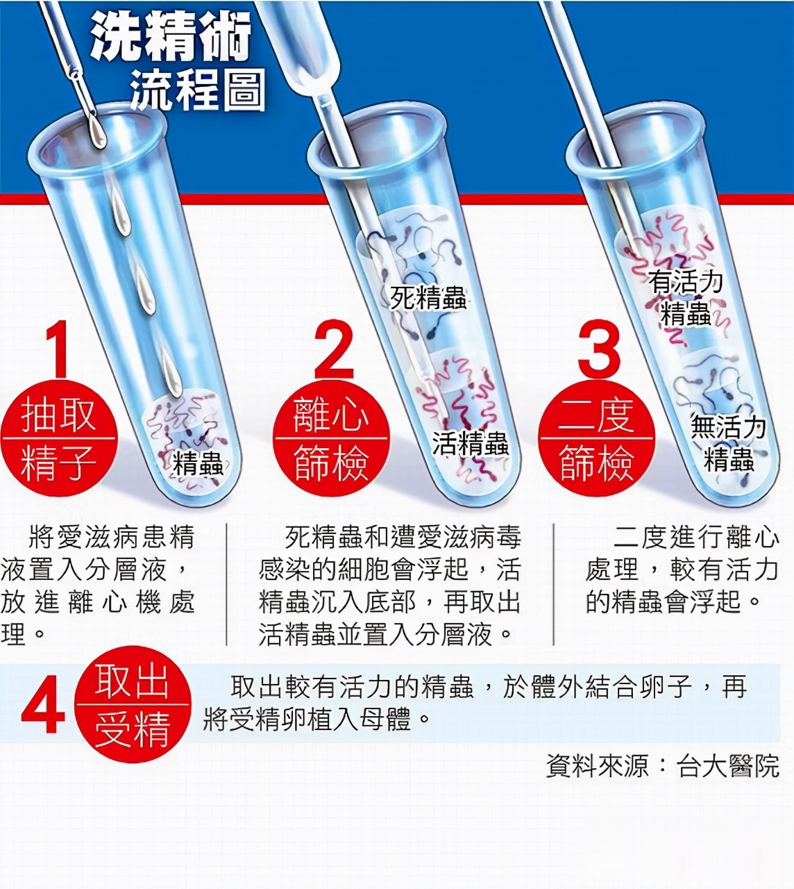 看呆医生:一次成功!医院人工授精太贵,英女子购买针筒自行操作