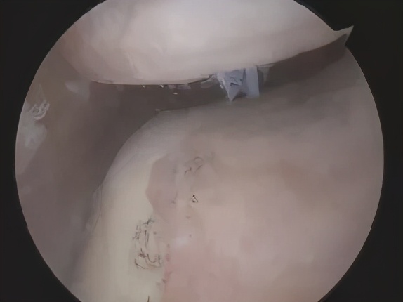 骨科医生教你一招搞定膝盖痛,不同部位膝关节