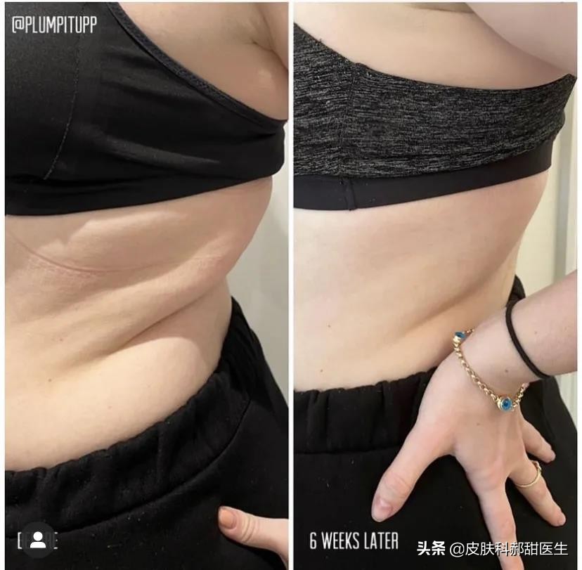 漾格医美皮秒怎么样,漾格医美场景视频