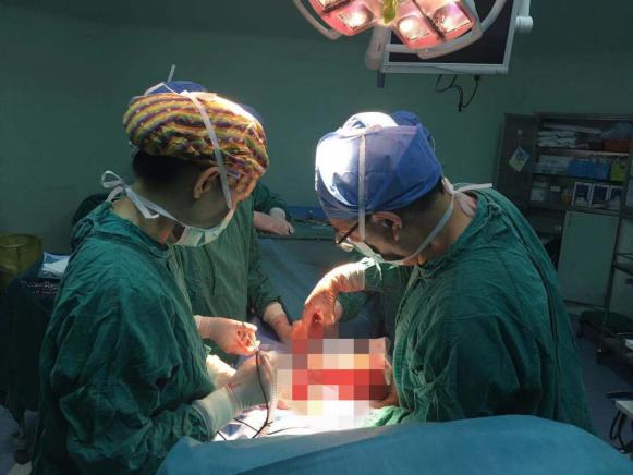 100斤女子肚子变大以为发胖原来是8斤肿瘤挤满腹腔