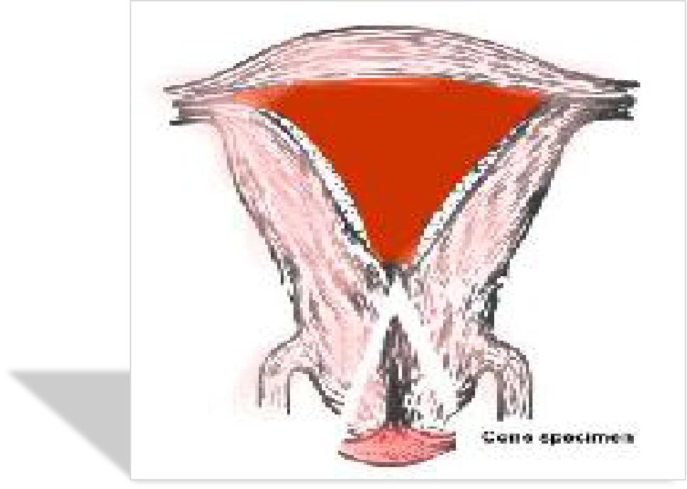 宫颈病变的诊断与治疗科普,宫颈低度病变如何治疗