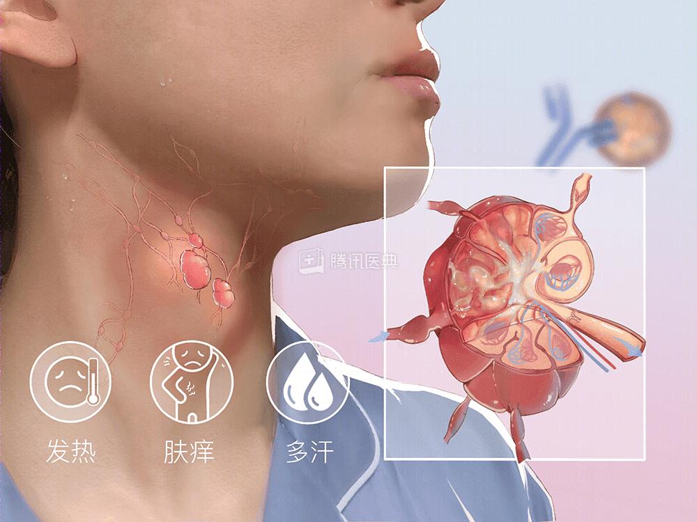 深圳癌症发病率最高的城市,深圳癌症多少例