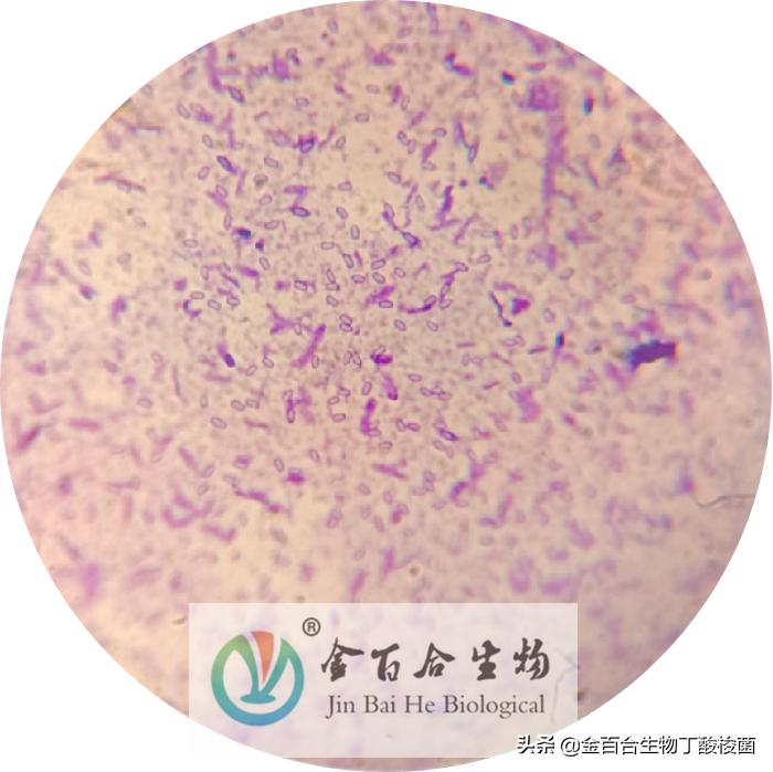 革兰氏染色显微镜下的图手绘,革兰染色用的显微镜是什么