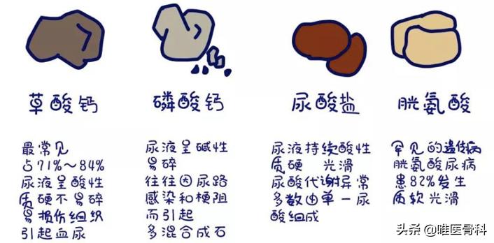 有肾结石的孩子可以喝补钙的吗,骨质疏松肾结石的正确补钙方法