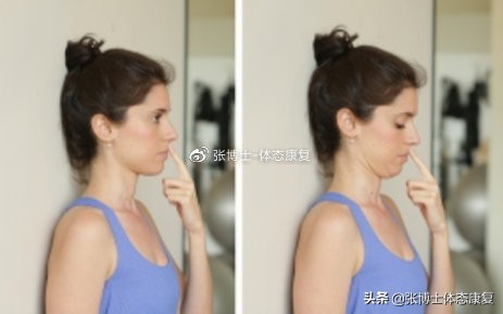 颈部僵硬康复训练方法,如何缓解肩颈肌肉僵硬