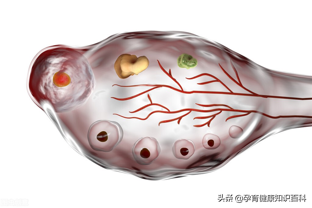 卵泡不排是不是就不能怀孕,卵泡也正常怎么就怀不上孕呢