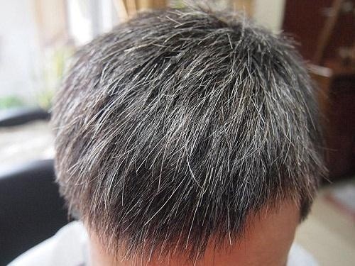 白头发很多显老怎么办,无需染发能使白发变黑发的秘诀