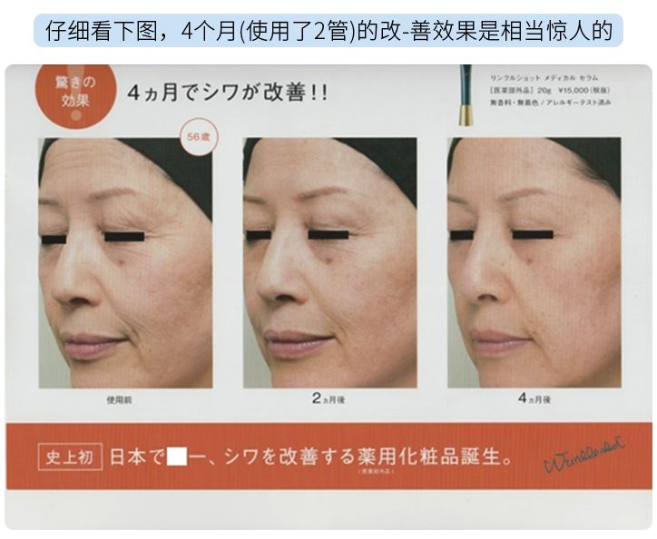 pola三剑客,pola祛皱精华40克