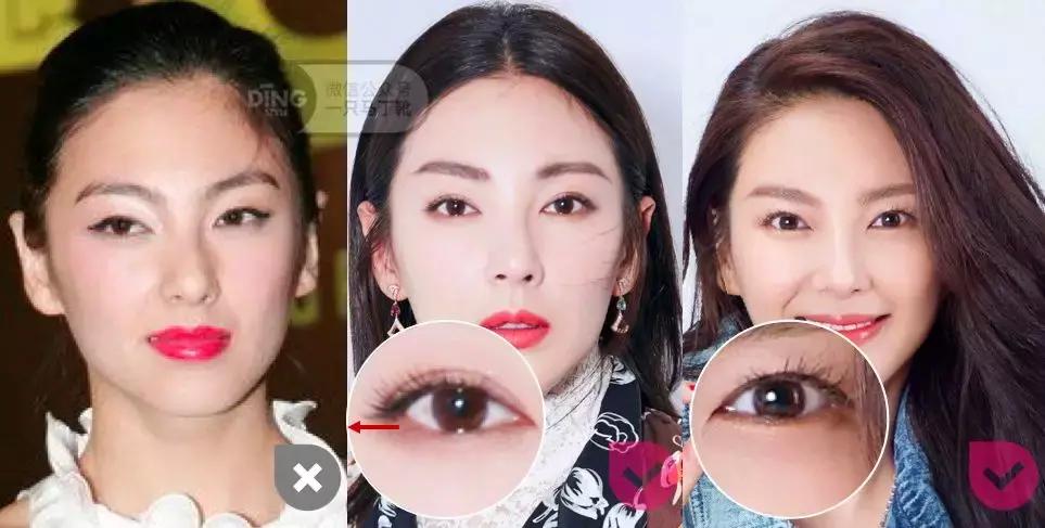 张雨绮杨丞琳对比,张雨绮眼型分析