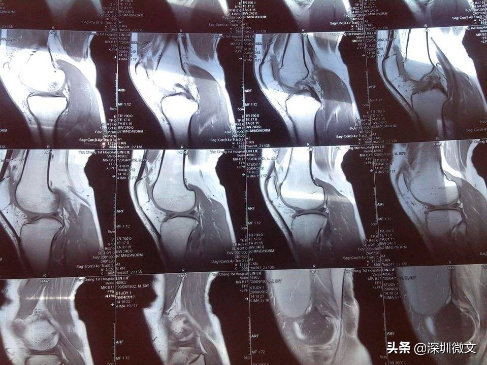 x光ct和核磁共振分别多少钱,ct与x光与核磁共振的区别是什么