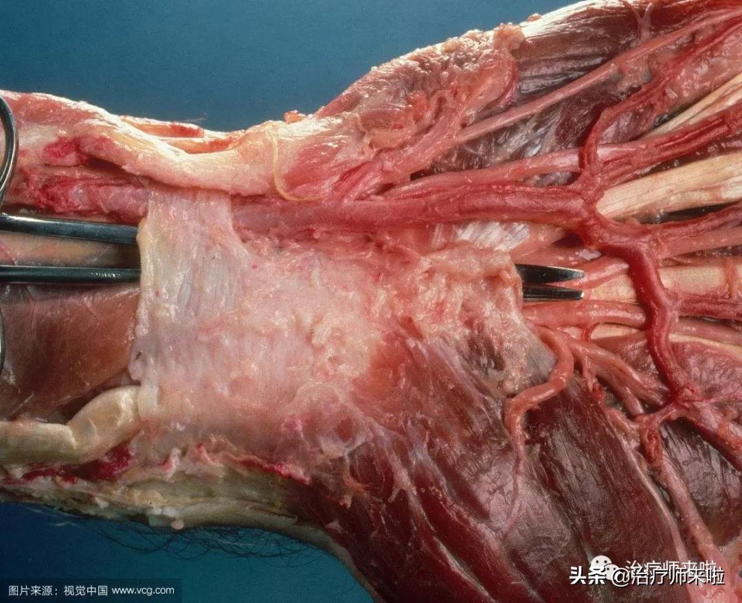 腕管综合征严重了可以不做手术吗,腕管综合征不治疗能养好吗