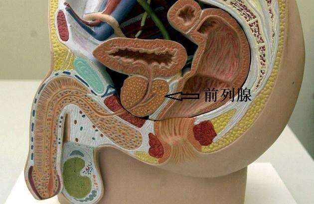 前列腺炎盆腔疼痛综合症怎么治疗,前列腺炎盆腔疼痛综合征怎么治疗