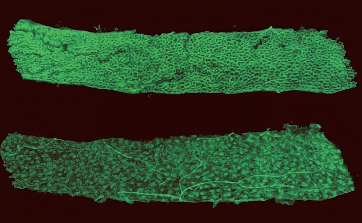 电鳗放电池为什么不会电到自己,电鳗的电是不是高压电