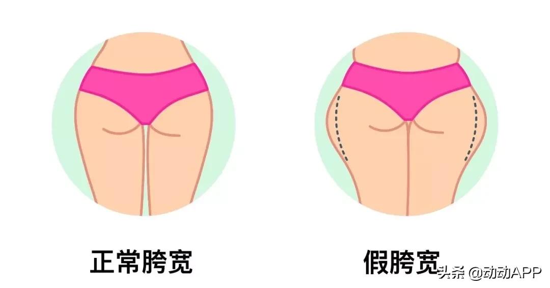 瘦假胯臀最快的方法,妈妈臀假胯宽臀部凹陷先练哪里