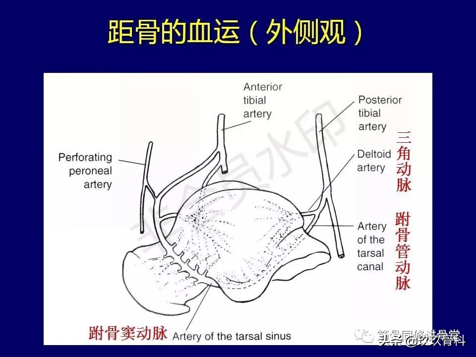 距骨骨折后遗症,距骨骨折怎么办
