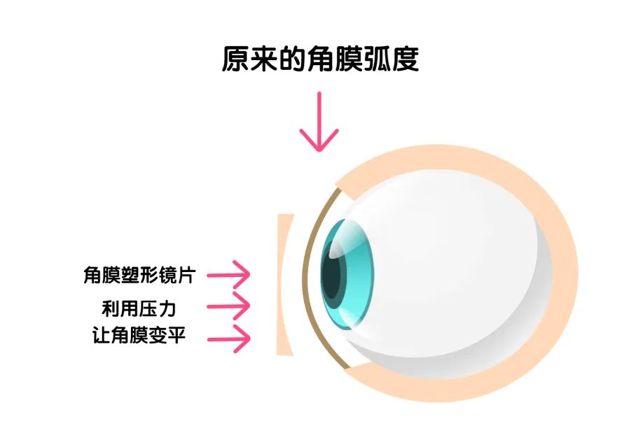 为治好近视，TA把眼睛搞瞎了
