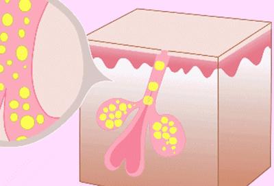 如何区分肤质干皮还是油皮,如何区别干皮或油皮肌肤