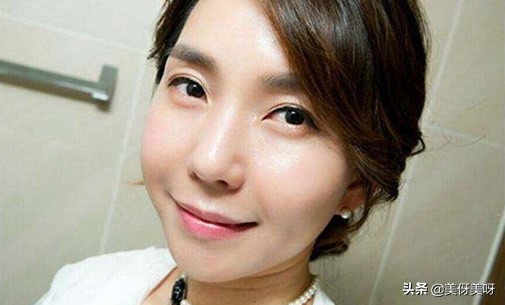 法令纹怎么消除最好的方法,法令纹深怎么去除法令纹