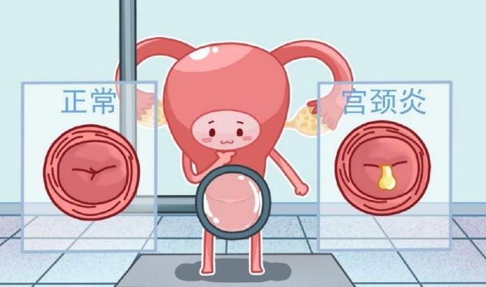 女人有妇科病是男人引起的吗,女人得妇科病和男人有关系吗