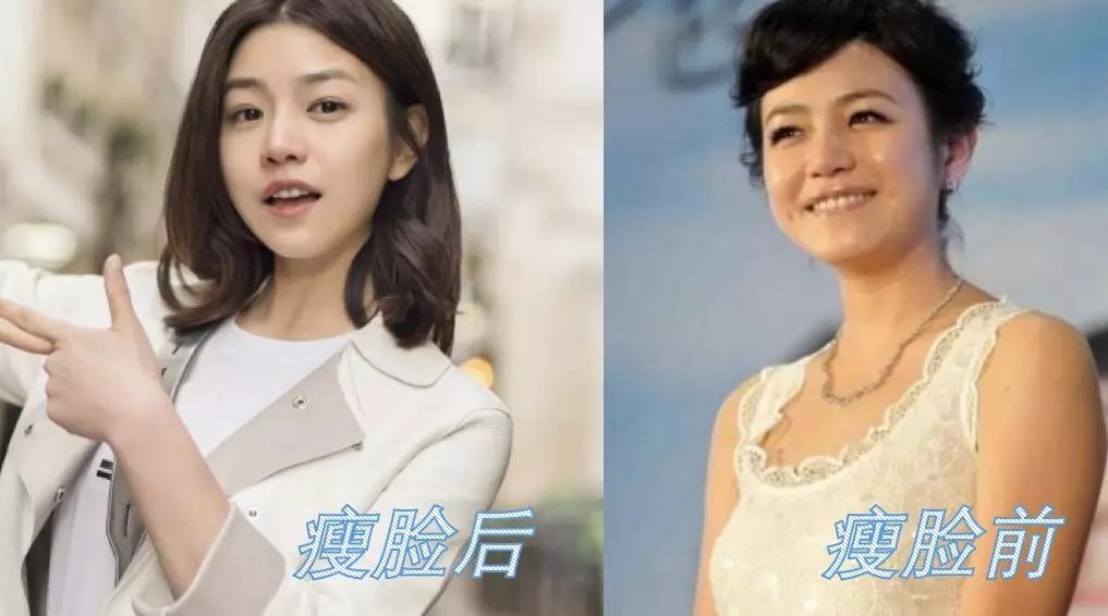 美容面部紧致提拉全过程,怎么做面部提拉改变大小脸