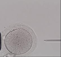 「喜报」河北省首例单精子冷冻患者成功升级为“准爸爸”