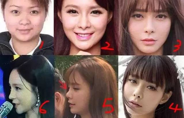 如何分辨鼻子整没整过,如何辨别鼻子有没有整过